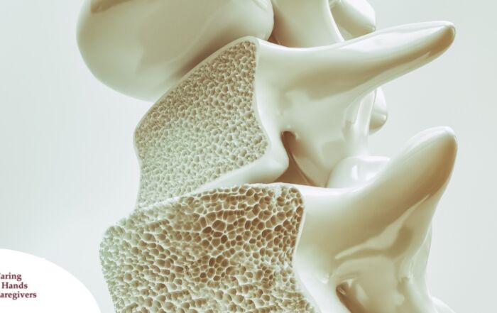 An image of a spine with the inside exposed represents osteoporosis.